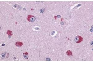 Immunohistochemical (Formalin/PFA-fixed paraffin-embedded sections) staining in human brain, neurons with TAAR1 polyclonal antibody . (TAAR1 抗体  (2nd Extracellular Domain))