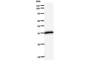 Western Blotting (WB) image for anti-SATB Homeobox 2 (SATB2) antibody (ABIN932998) (SATB2 抗体)