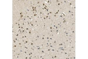 IHC analysis of MBD4/MED1 using anti-MBD4/MED1 antibody (ABIN7600185).