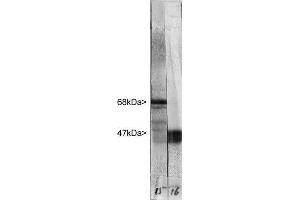Western blot of whole rat cerebellum homogenate stained with ABIN1842266 in the left strip, at dilution of 1:20,000. (NEFL 抗体)