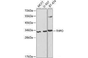 Western blot analysis of extracts of various cell lines using THPO Polyclonal Antibody at dilution of 1:1000. (Thrombopoietin 抗体)