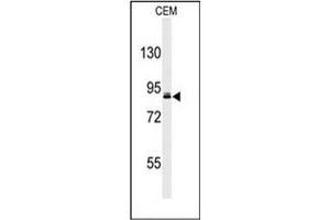 Western blot analysis of URG4 Antibody (Center) in CEM cell line lysates (35ug/lane).