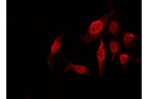 ABIN6274102 staining COLO205 by IF/ICC. (T-Box 1 抗体  (C-Term))