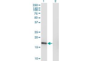 Western Blot analysis of SNX3 expression in transfected 293T cell line by SNX3 monoclonal antibody (M10), clone 3A9. (Sorting Nexin 3 抗体  (AA 1-113))