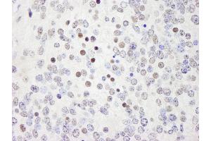 Immunohistochemistry (IHC) image for anti-Werner Helicase Interacting Protein 1 (WRNIP1) (AA 400-450) antibody (ABIN7449035) (WRNIP1 抗体  (AA 400-450))