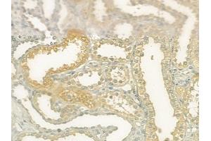ABIN6264982 and ABIN6277611 at 1/100 staining human normal kidney tissue by IHC-P.