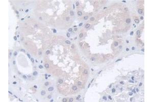 Immunohistochemistry (IHC) image for anti-Actin Related Protein 2/3 Complex, Subunit 2, 34kDa (ARPC2) (AA 1-300) antibody (ABIN7441580)