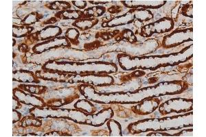 Immunohistochemistry (IHC) image for anti-cAMP Responsive Element Binding Protein 1 (CREB1) (pSer142) antibody (ABIN6254981)