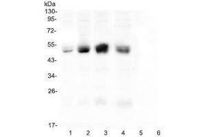 Western blot testing of CAR antibody and rat samples 1: pancreas (Coxsackie Adenovirus Receptor 抗体  (C-Term))