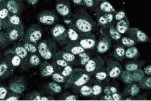 Immunofluorescence staining of human endothelial cells. (HDAC3 抗体  (AA 309-425))
