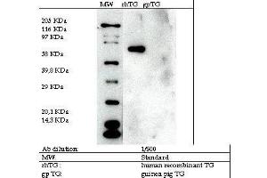 Image no. 2 for anti-Transglutaminase 2 (C Polypeptide, Protein-Glutamine-gamma-Glutamyltransferase) (TGM2) antibody (ABIN347018) (Transglutaminase 2 抗体)
