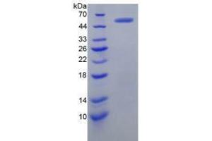 Image no. 2 for Protein L-Myc (MYCL) (AA 184-454) (Active) protein (His tag,GST tag) (ABIN5665922)
