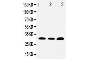 Anti-Tollip antibody, Western blotting Lane 1: PANC Cell Lysate Lane 2: HELA Cell Lysate Lane 3: U87 Cell Lysate (TOLLIP 抗体  (C-Term))