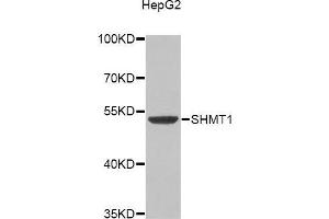 Western blot analysis of extracts of HepG2 cell line, using SHMT1 antibody. (SHMT1 抗体)