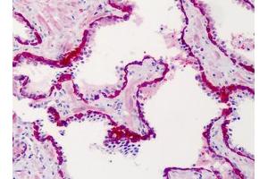 Human Prostate: Formalin-Fixed, Paraffin-Embedded (FFPE) (SLFN12 抗体  (C-Term))