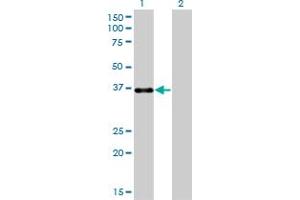 Western Blotting (WB) image for anti-Paired-Like Homeodomain 1 (PITX1) (AA 225-313) antibody (ABIN562248)