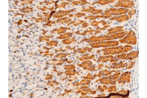 ABIN6267308 at 1/100 staining rat gastric tissue sections by IHC-P. (C-JUN 抗体  (pTyr170))