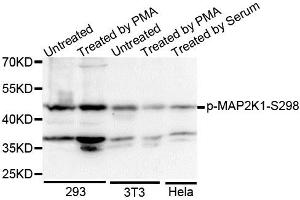 Western blot analysis of extracts of various cell lines, using Phospho-MAP2K1-S298 antibody. (MEK1 抗体  (pSer297))