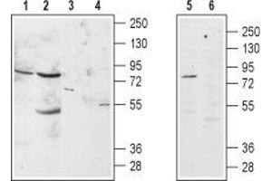 Western blot analysis of α1B-Adrenoceptor in rat brain (lanes 1 and 3), rat kidney (lanes 2 and 4) and GH3 cell line (lanes 5 and 6) lysates: - 1,2,5. (ADRA1B 抗体  (Extracellular, N-Term))