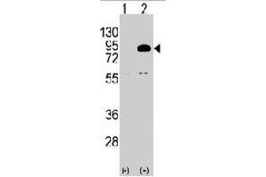 Western blot analysis of PIK3R2 polyclonal antibody  (arrow). (PIK3R2 抗体  (N-Term))