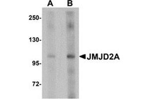 Western Blotting (WB) image for anti-Lysine (K)-Specific Demethylase 4A (KDM4A) (Middle Region) antibody (ABIN1030968) (KDM4A 抗体  (Middle Region))