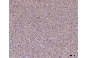IHC analysis of WDR7 using anti-WDR7 antibody (ABIN7600939). (WDR7 抗体  (AA 258-1292))