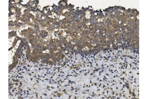 IHC analysis of EIF2AK4 using anti-EIF2AK4 antibody (ABIN7600753).