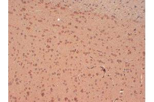 Immunohistochemistry (IHC) image for anti-Potassium Voltage-Gated Channel, Shaker-Related Subfamily, Member 4 (KCNA4) (Internal Region) antibody (ABIN6658072)