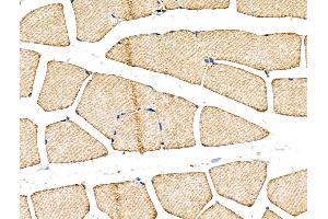 ABIN6260500 and ABIN6268739 at 1/100 staining Rat muscle tissue by IHC-P. (Cathepsin D 抗体  (C-Term))