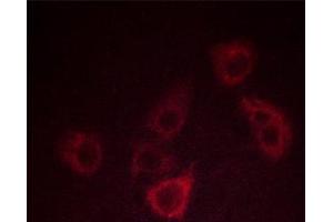 Immunofluorescence (fixed cells) (IF/ICC) image for anti-Chemokine (C-X-C Motif) Receptor 2 (CXCR2) (pSer347) antibody (ABIN6256283)