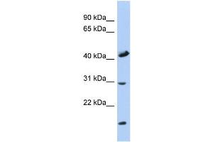 WB Suggested Anti-COX18 Antibody Titration: 0. (COX18 抗体  (Middle Region))