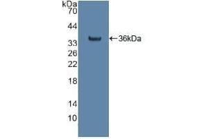 Detection of Recombinant citrate synthase, Human using Polyclonal Antibody to Citrate Synthase (CS) (CS 抗体  (AA 103-394))
