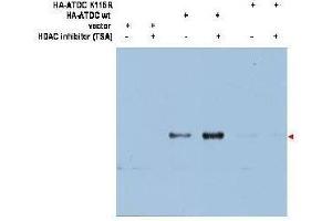 Western blot using  affinity purified anti-ATDC (Ac-K116) antibody shows detection of a 66 kDa band corresponding to over-expressed, acetylated lysine (K116) ATDC (arrowhead) in transfected 293T cells. (TRIM29 抗体  (Internal Region))