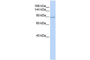 WB Suggested Anti-ZC3H7A Antibody Titration:  0.