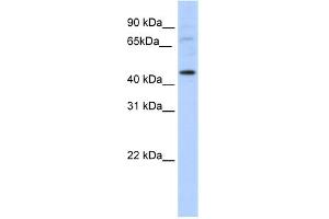 WB Suggested Anti-LMX1A Antibody Titration:  5. (LMX1A 抗体  (C-Term))