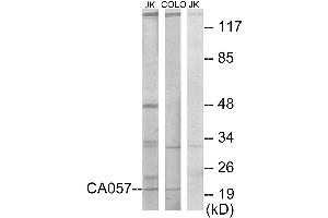 Western blot analysis of extracts from Jurkat cells and COLO205 cells, using CA057 antibody. (C1orf57 抗体)