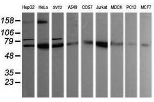 Image no. 2 for anti-SEC14 and Spectrin Domains 1 (SESTD1) antibody (ABIN1501067) (SESTD1 抗体)