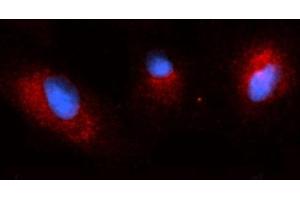 Immunofluorescence (IF) image for anti-Osteoactivin (GPNMB) (AA 22-474) antibody (PE) (ABIN5566465) (Osteoactivin 抗体  (AA 22-474) (PE))