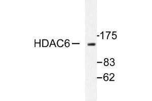 Image no. 1 for anti-Histone Deacetylase 6 (HDAC6) antibody (ABIN265458) (HDAC6 抗体)