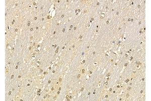 ABIN6264492 and ABIN6279008 at 1/100 staining rat brain tissue by IHC-P.