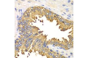 Immunohistochemistry of paraffin-embedded human prostate using DDX58 antibody at dilution of 1:100 (x40 lens). (DDX58 抗体)