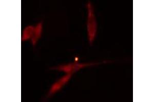 ABIN6274296 staining HeLa cells by IF/ICC. (HNRNPH2 抗体  (Internal Region))
