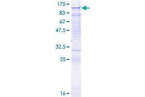 Image no. 1 for Myosin IXA (MYO9A) (AA 1-729) protein (GST tag) (ABIN1311836) (Myosin IXA Protein (MYO9A) (AA 1-729) (GST tag))