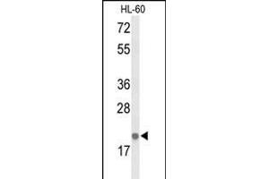 Western blot analysis of IL26 Antibody (Center) (ABIN653426 and ABIN2842870) in HL-60 cell line lysates (35 μg/lane). (IL-26 抗体  (AA 88-115))
