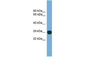 WB Suggested Anti-EIF4E2 Antibody Titration: 0. (EIF4E2 抗体  (N-Term))