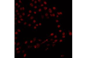 Immunofluorescence (fixed cells) (IF/ICC) image for anti-Zinc Finger, MYND-Type Containing 8 (ZMYND8) (Internal Region) antibody (ABIN6264251)