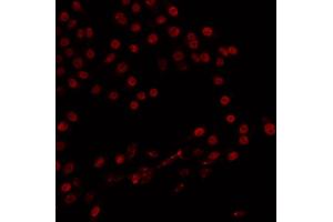 ABIN6266824 staining 293 by IF/ICC. (ZMYND8 抗体  (Internal Region))