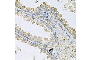Immunohistochemistry of paraffin-embedded human prostate using PPIC antibody (ABIN6003569) at dilution of 1/100 (40x lens). (PPIC 抗体)