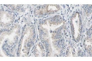 ABIN6276862 at 1/100 staining Human prostate tissue by IHC-P. (FKBP1A 抗体  (N-Term))
