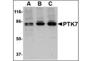 Western blot analysis of PTK7 in (A) human, (B) mouse and (C) rat colon tissue lysate with this product at 1 μg/ml. (PTK7 抗体  (N-Term))